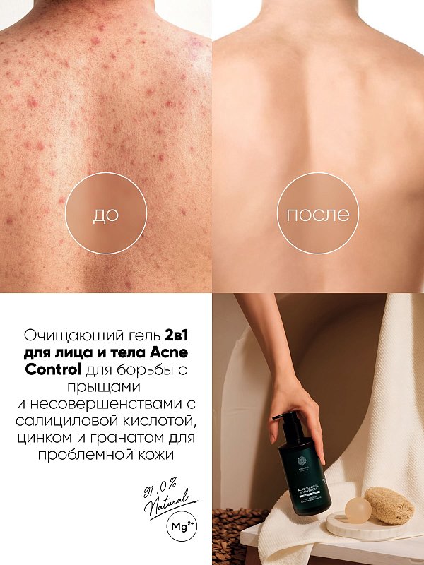 Гель для душа «ACNE CONTROL» 2