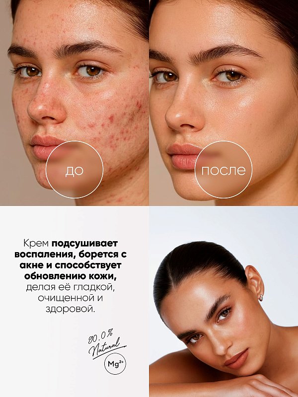 Крем для тела восстанавливающий "ACNE CONTROL", 250 мл 2