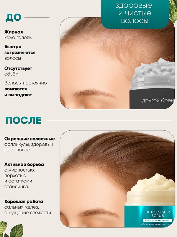 Маска-скраб для кожи головы "Detox Scalp Scrub", 250 г 2